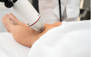 Imagem em Destaque - Laser vascular em Manaus: técnica moderna para eliminar vasinhos com segurança