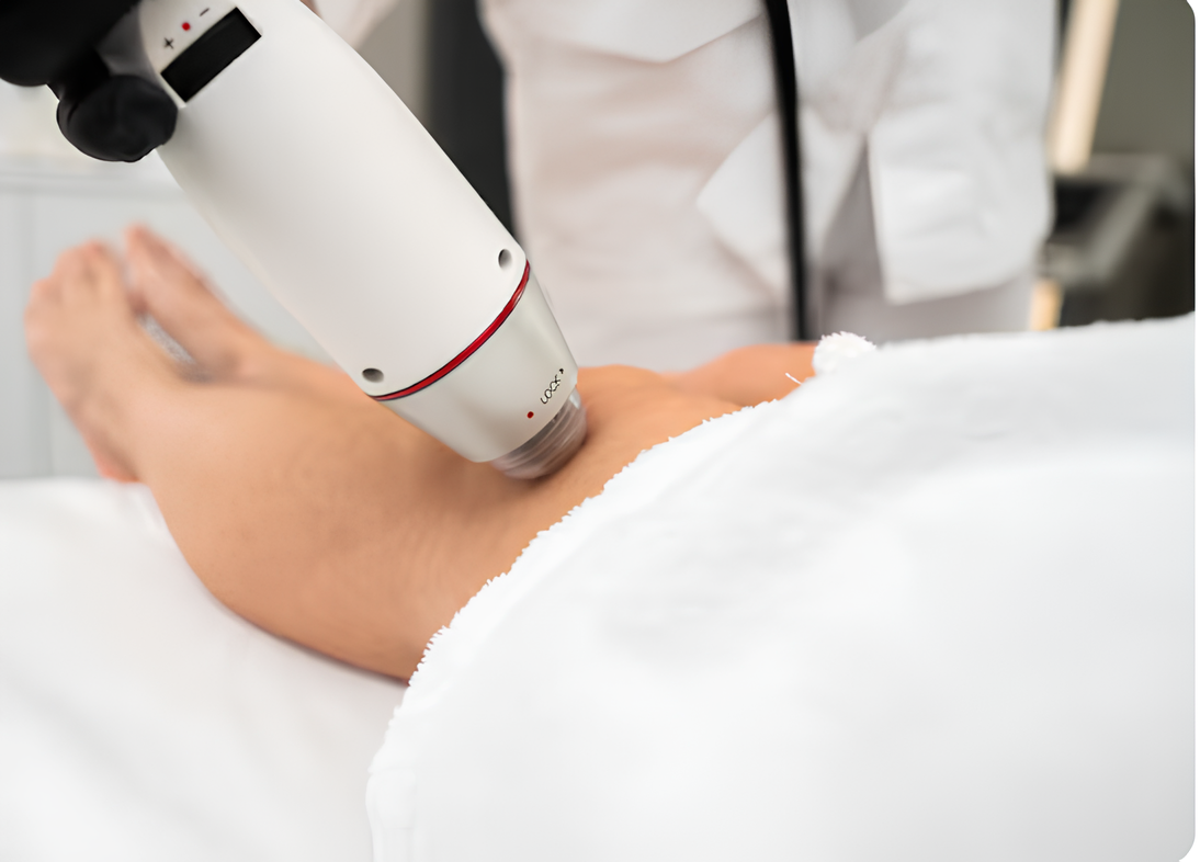 Laser vascular em Manaus: técnica moderna para eliminar vasinhos com segurança