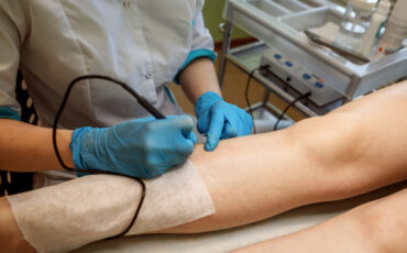 Imagem em Destaque - Laser vascular em Manaus: resultados rápidos e tratamento seguro