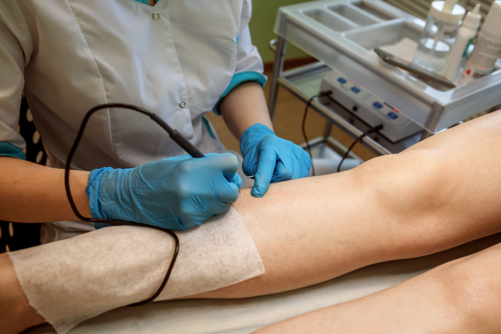 Laser vascular em Manaus: resultados rápidos e tratamento seguro