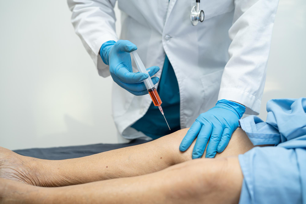 Fleboestética em Manaus: atendimento exclusivo para saúde vascular