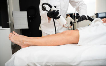 Imagem em Destaque - Laser vascular em Manaus: resultados rápidos e tratamento seguro