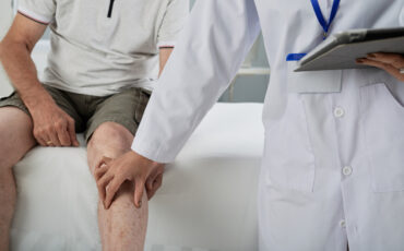 Imagem em Destaque - Especialista em varizes em Manaus: diagnóstico e tratamento com médico angiologista