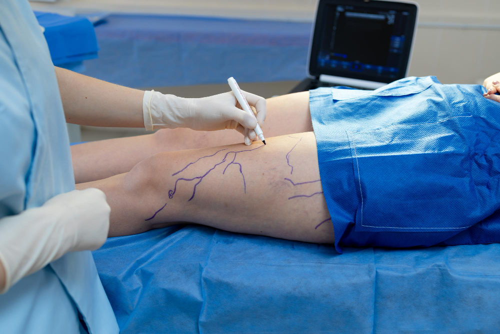 Cirurgião vascular em Manaus: diagnóstico e tratamento completo para problemas de circulação