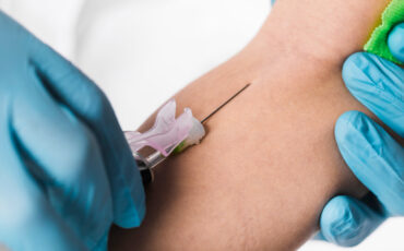 Imagem em Destaque - Fleboestética em Manaus: estética e saúde para tratar varizes e vasinhos