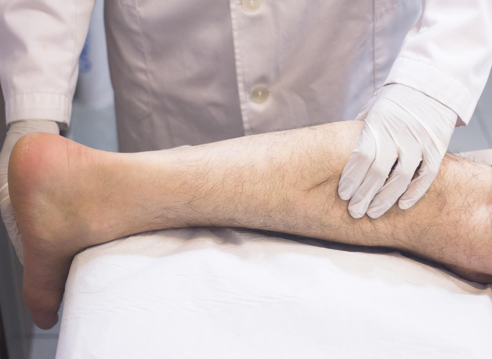 Angiologista em Manaus: cuide da sua circulação com médico especialista em varizes