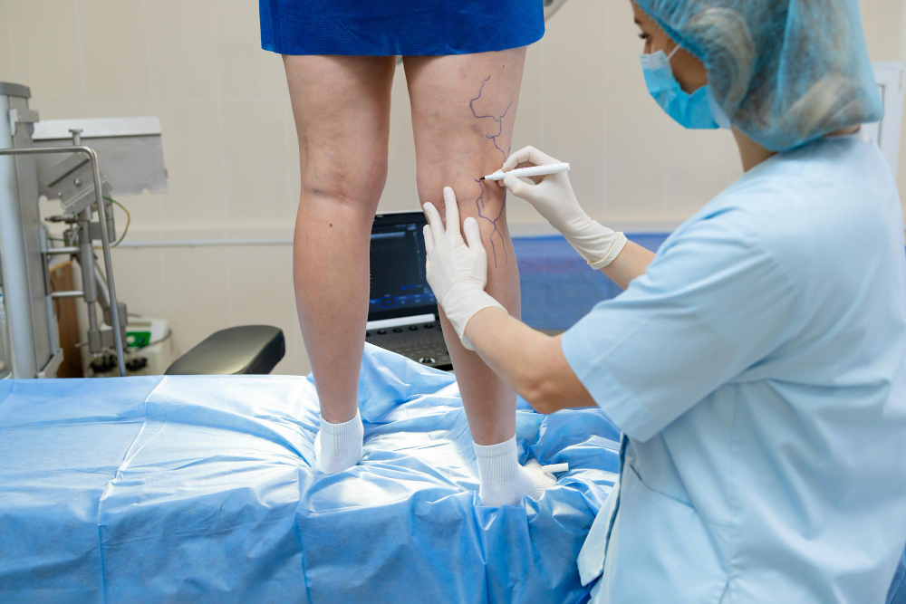 Cirurgião vascular particular em Manaus: atendimento especializado para varizes e circulação