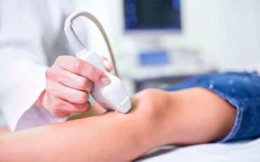 Imagem em Destaque - Ultrassom Doppler vascular em Manaus: diagnóstico vascular preciso com especialista e atendimento seguro