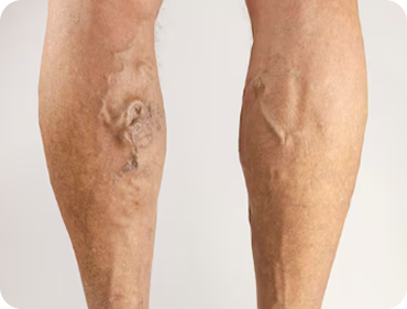Check-up Vascular