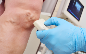 Imagem em Destaque - Exame Doppler vascular em Manaus: diagnóstico preciso para problemas circulatórios