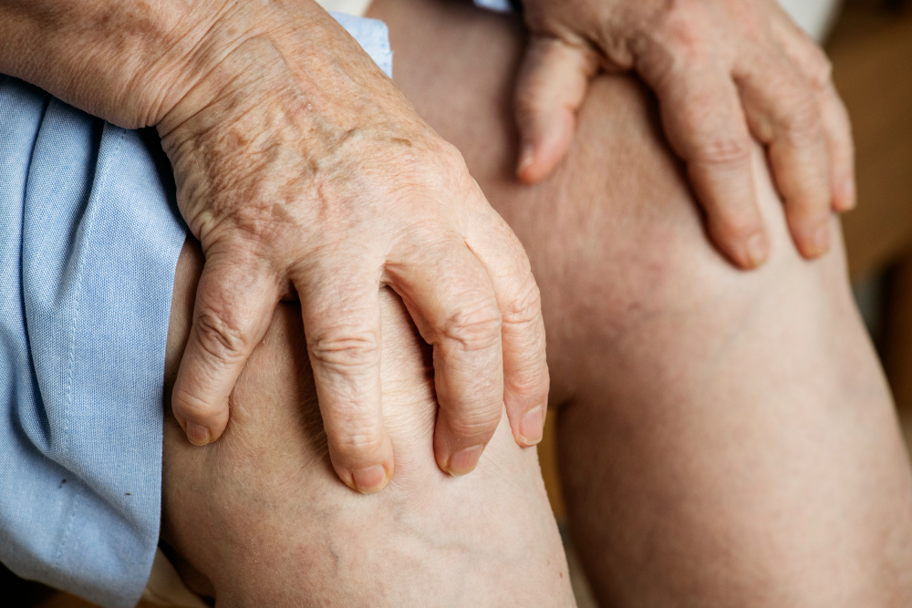 Veias aparentes na perna: quando elas indicam a necessidade de tratamento vascular