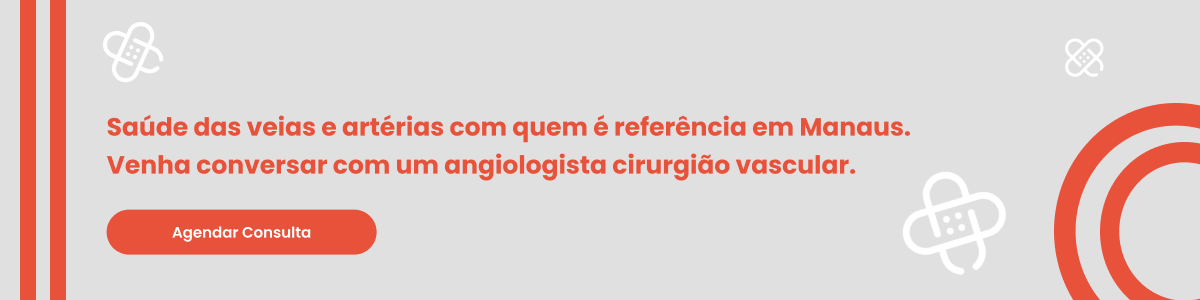 Tratamento de espuma para varizes valor em Manaus: descubra o que pode influenciar o custo do tratamento