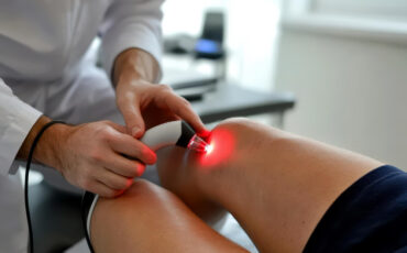 Imagem de Destaque Post - Cirurgia vascular laser em Manaus: conheça as opções de tratamento e veja quando o procedimento pode ser indicado