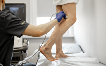 Imagem em Destaque - Exame vascular em Manaus: diagnóstico especializado para investigar alterações na circulação e orientar o tratamento adequado